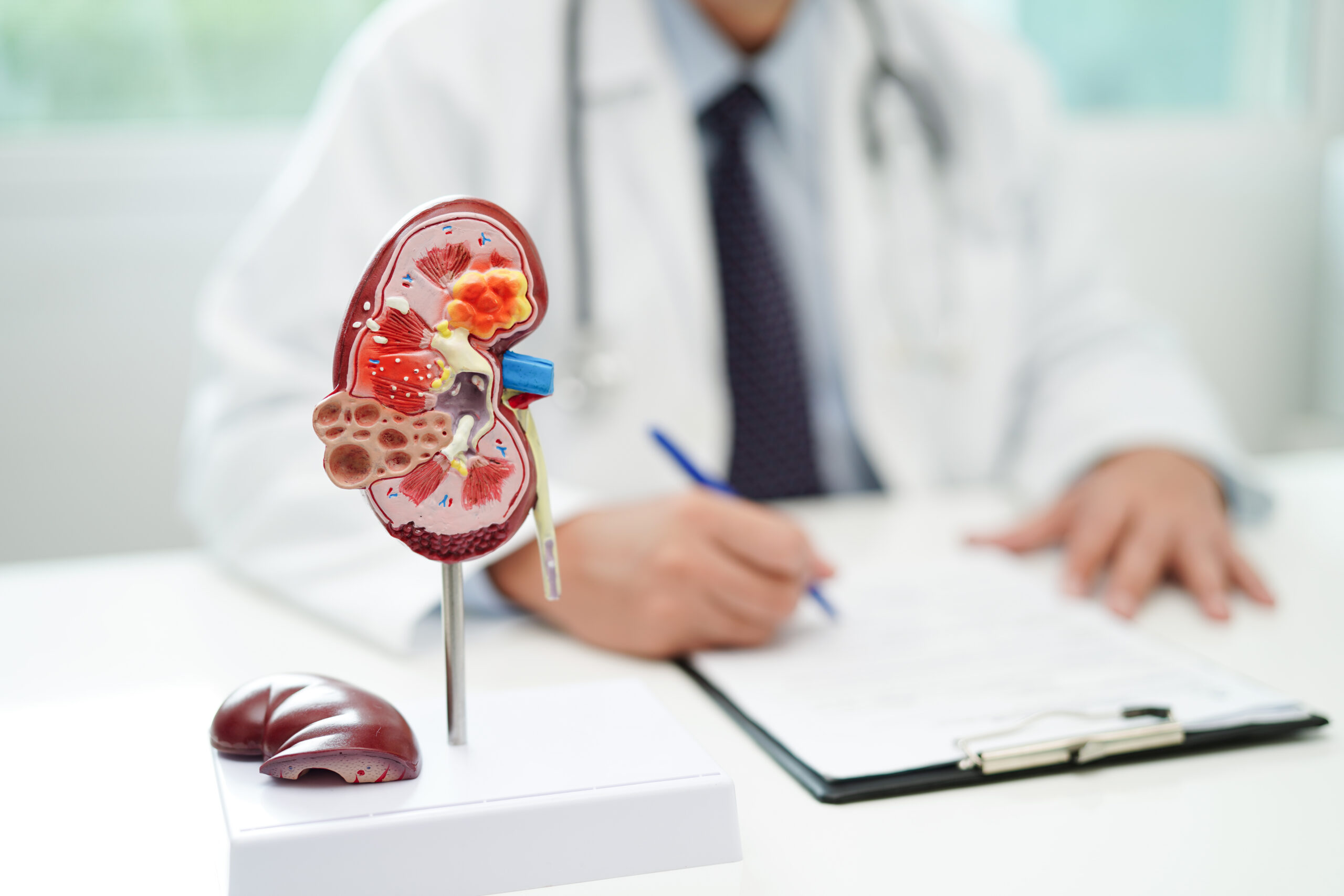 Chronic kidney disease, doctor with model for treatment urinary